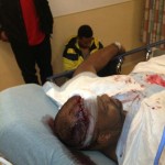 Chris-Brown-drake-fight-security-guard-injury
