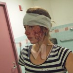 chris-brown-drake-club-fight-face-gash-chin-injured-fan-hollie
