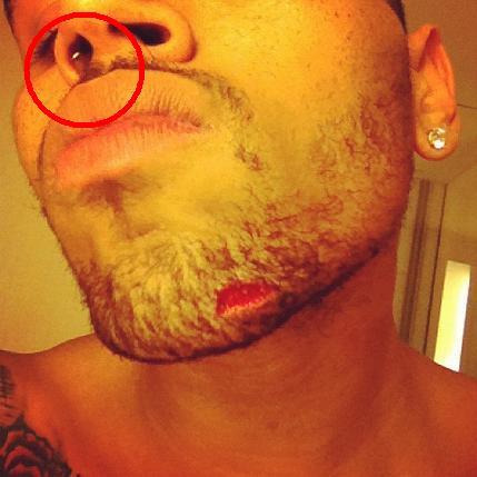 chris-brown-drake-club-fight-face-gash-chin-nose-ring